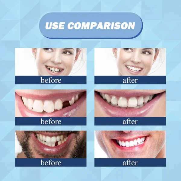 Eelhoe - Thermal Forming False Teeth (Original) - Image 3